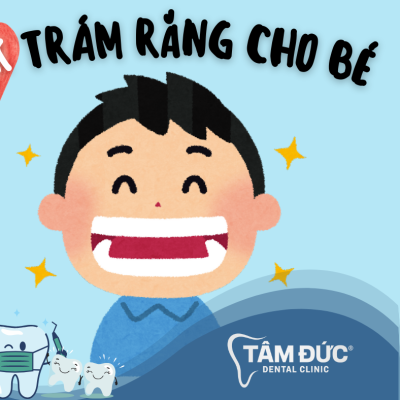 Trám răng cho bé