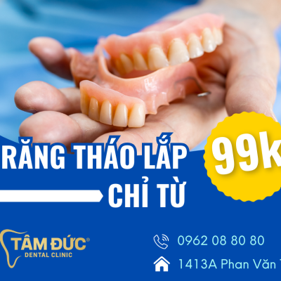 răng tháo lắp