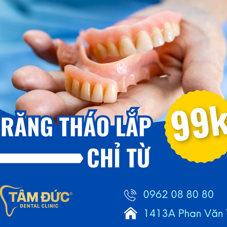 răng tháo lắp